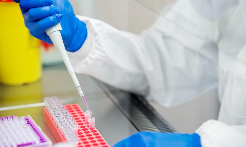 Autres prélèvements