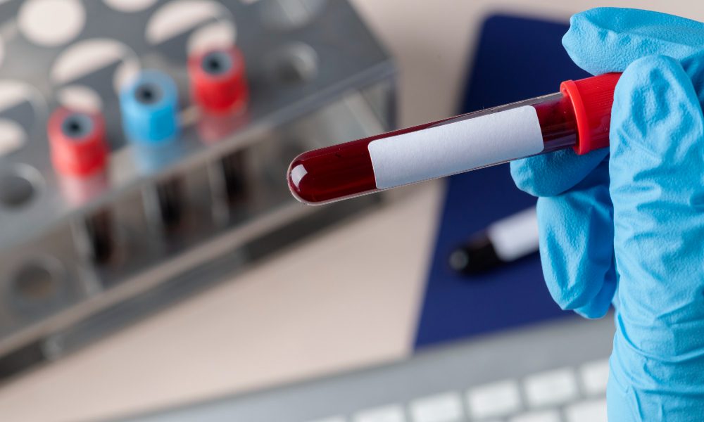Prélèvements sanguins